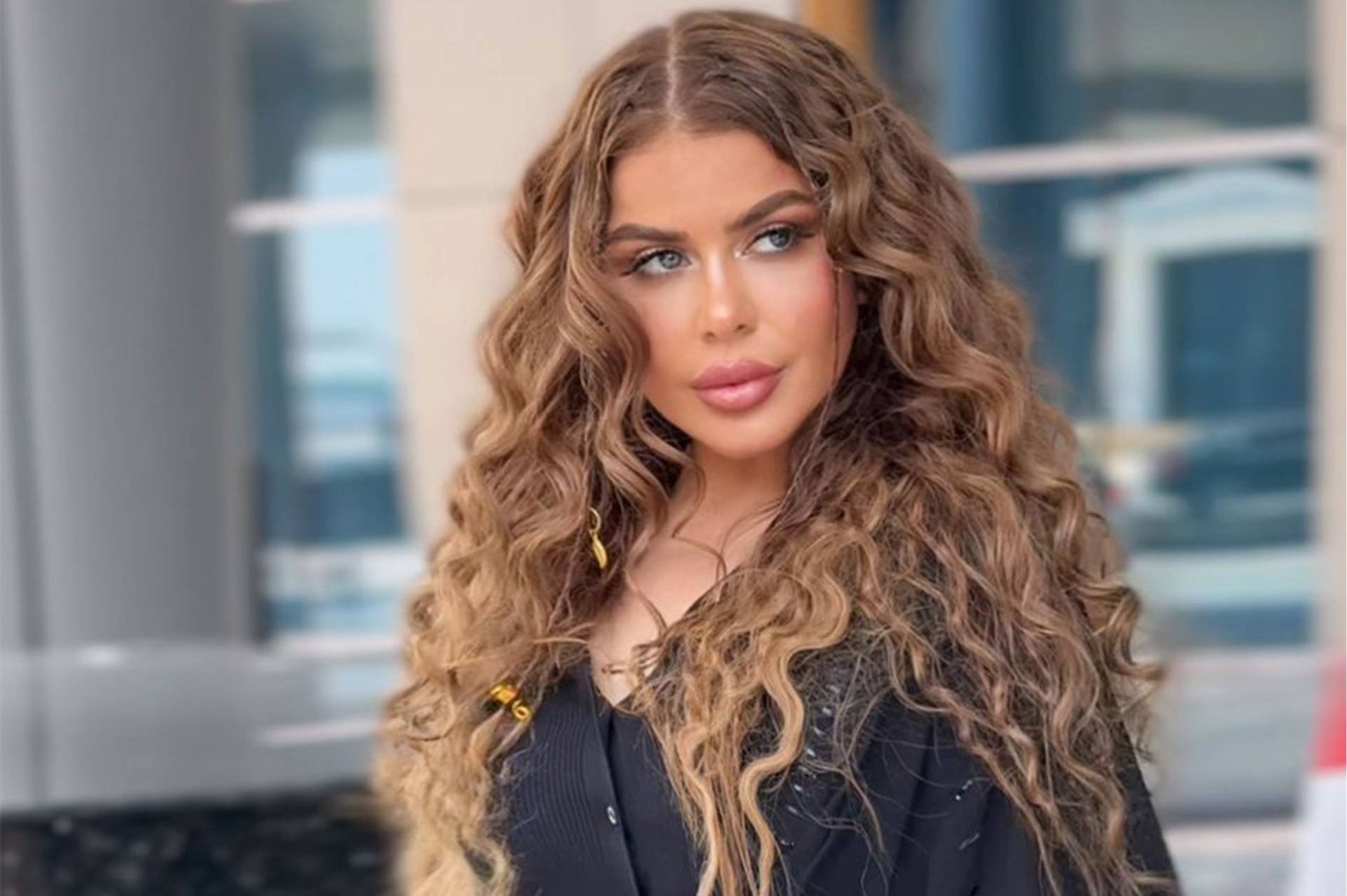 Real patient Before & After Real patient Before & After