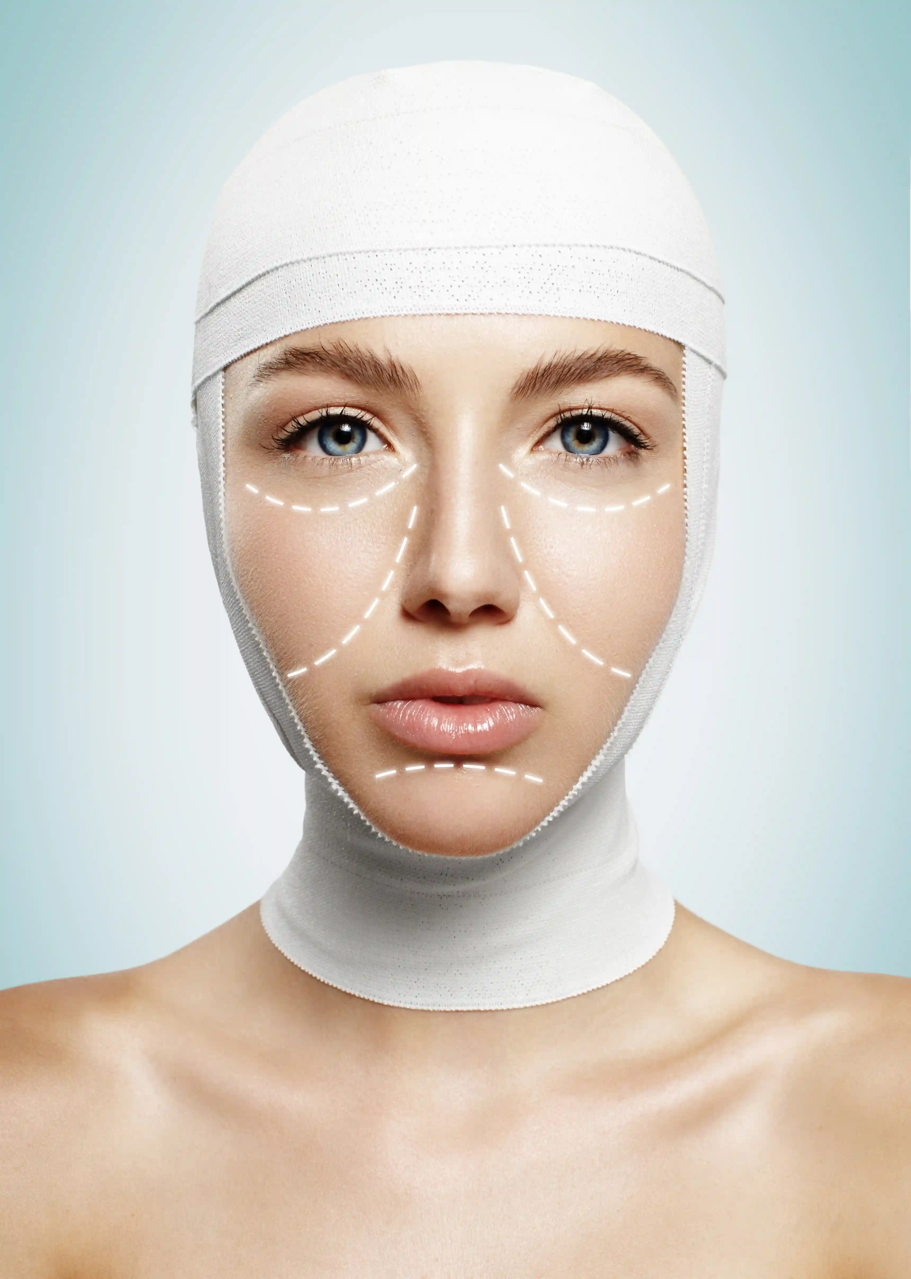 Face Lift