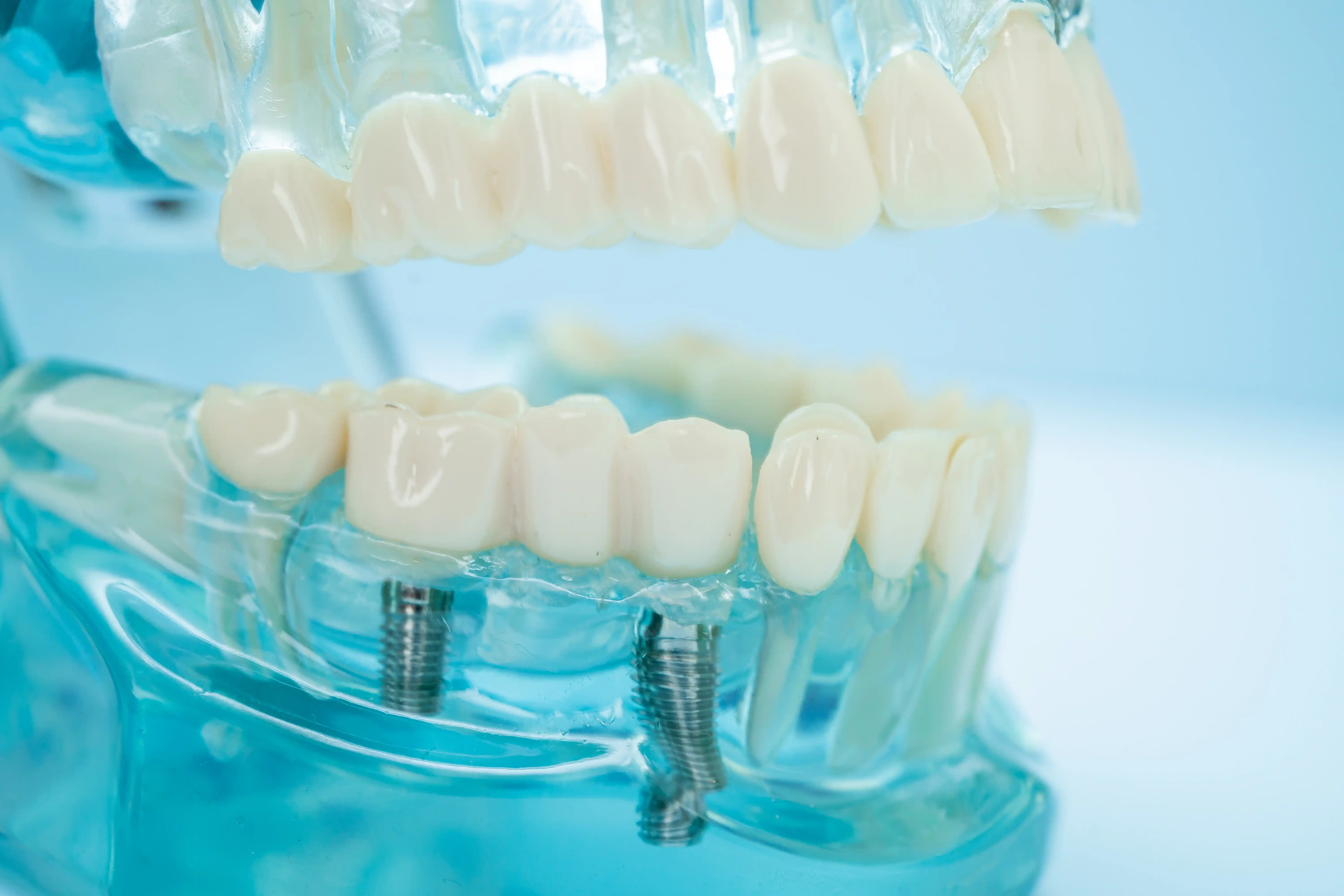 Oral and Maxillofacial Surgery & Dental Implants Clinic