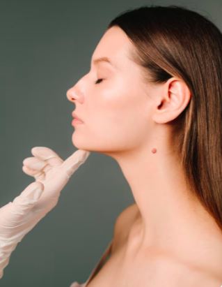Chin Augmentation