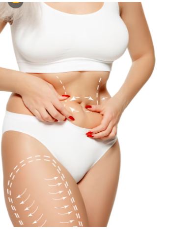 Trunkplasty (Beltlift) 2