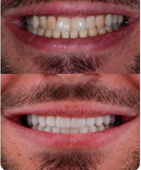 dental care before after 2